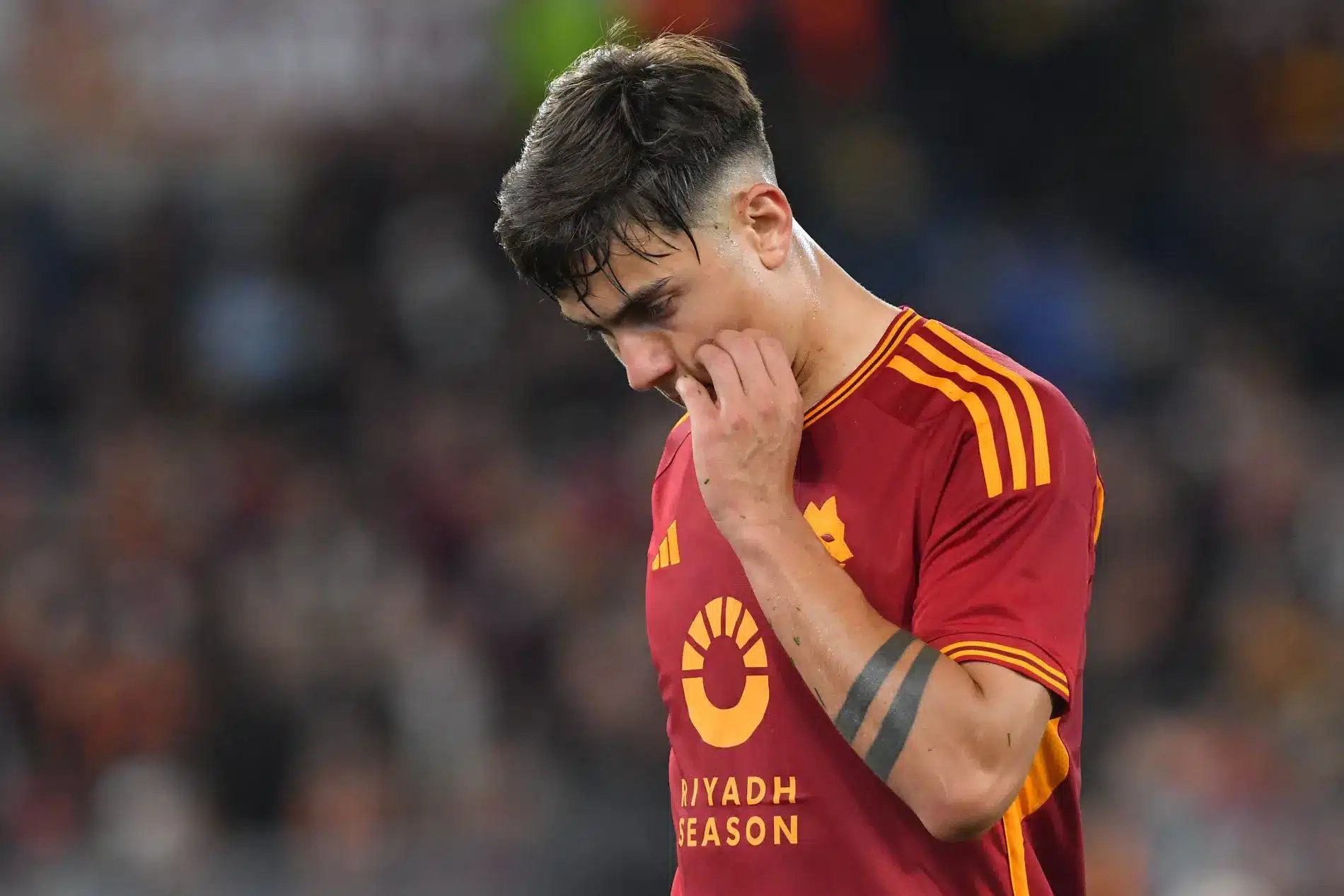 roma dybala oggi si opera i tempi di recupero da Sololaroma.it roma dybala oggi si opera i tempi di recupero